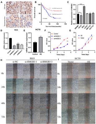 HMGB3 is a Potential Therapeutic Target by Affecting the Migration and Proliferation of Colorectal Cancer